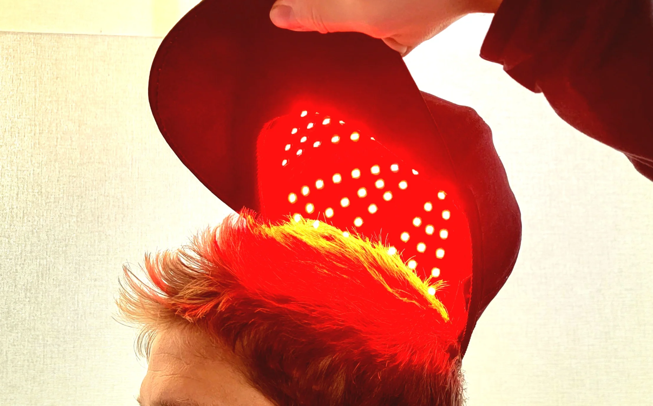 The PBM CAP - Image 4