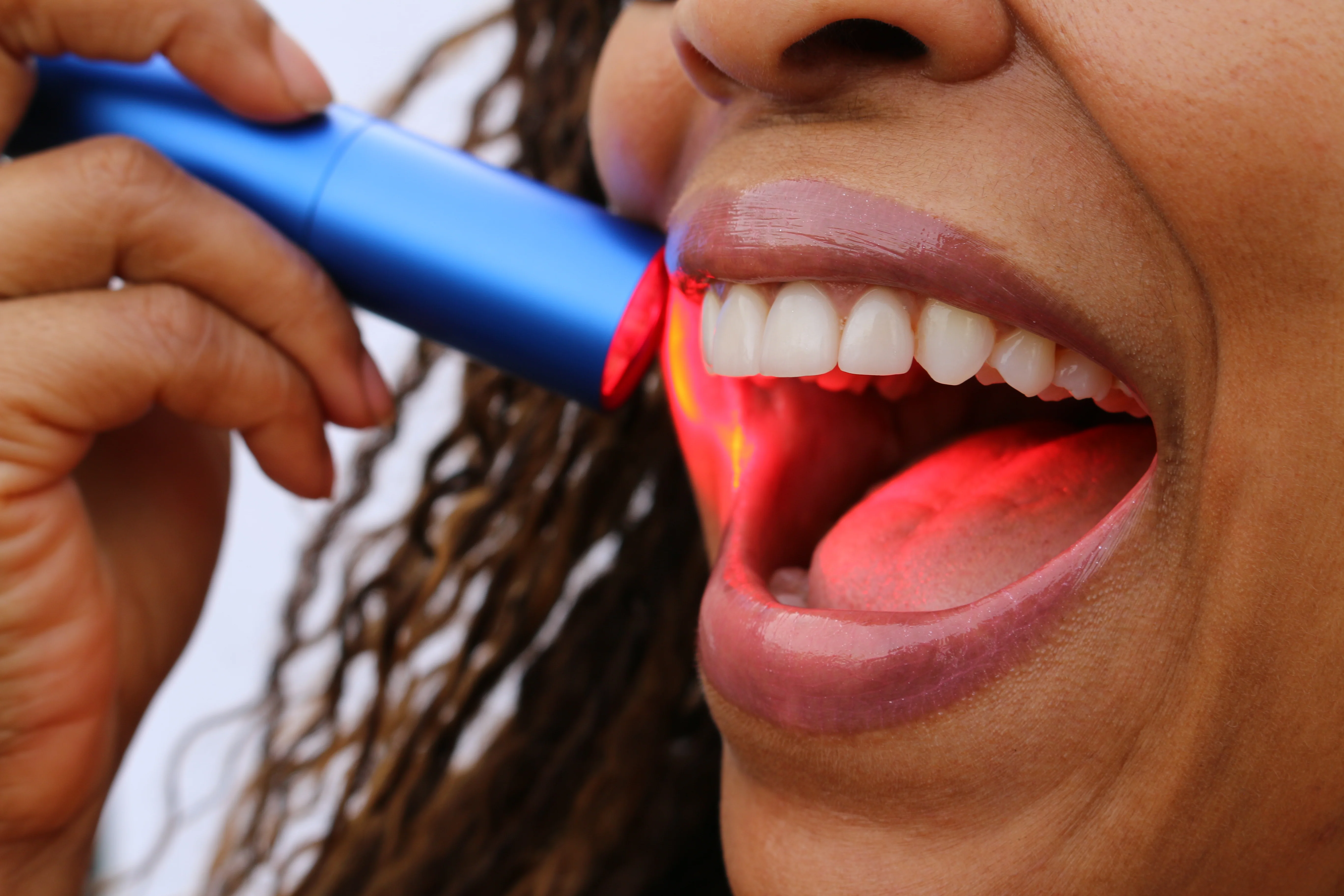 The original PBM Light +™ - Image 3