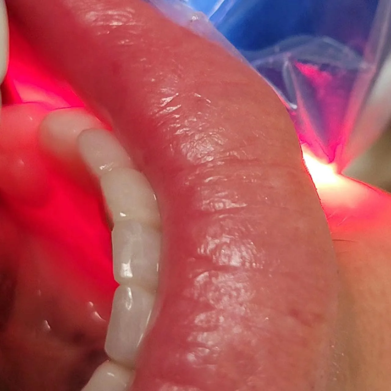 The original PBM Light +™ - Image 7